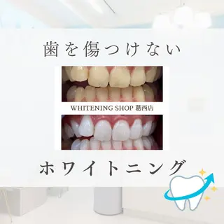 メンズ ホワイトニング ショップ葛西店のその他イメージ