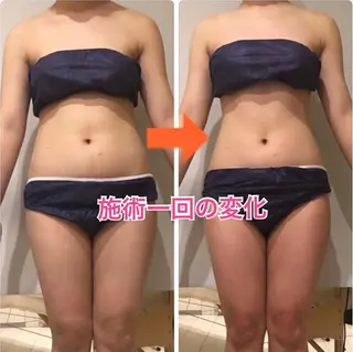 ショート カラー パーマ ヘアアレンジ メンズ キッズ ネイル マツエク・マツパ ‍痩身＆ボディ 結果出し🌟丹野のエステ・リラクイメージ