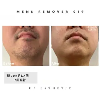 メンズ ウプエステティック所属・韓国肌管理 ウプエステティックのエステ・リラクイメージ