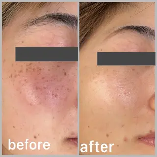 more.所属・more. RICOのマツエク・マツパデザイン