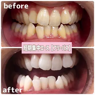 メンズ ホワイトニングサロン BE WHITE金山のその他イメージ