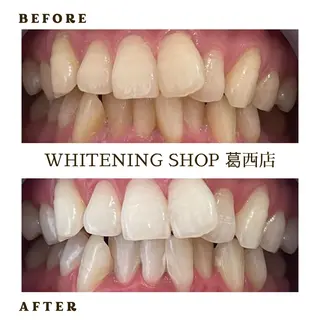 メンズ ホワイトニング ショップ葛西店のその他イメージ