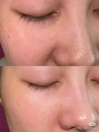 ネイル aliaハイフ&水光ジェットサロン所属・aliaハーブ水光店 エステティシャン募集のエステ・リラクイメージ