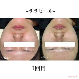 salon merci和泉のエステ・リラクイメージ