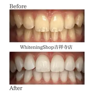 ホワイトニングショッ 吉祥寺2号店のその他イメージ