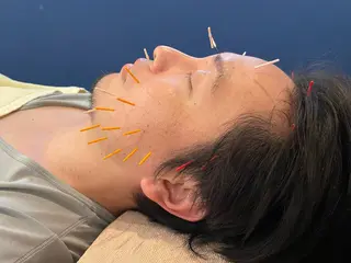 美容鍼　蒼月-aotsuki-所属・美容鍼「蒼月」 -アオツキ-のエステ・リラクイメージ