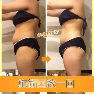 ロング カラー パーマ ヘアアレンジ メンズ キッズ ネイル マツエク・マツパ ‍痩身＆ボディ 結果出し🌟丹野のエステ・リラクイメージ