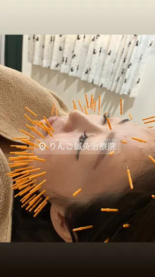 美容鍼灸女性専用 りんご鍼灸治療院のその他イメージ
