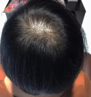 HFケアサロン NOBUKOのエステ・リラクイメージ