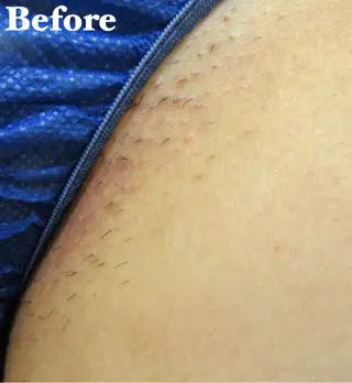 MIMI 吉祥寺本店のエステ・リラクイメージ