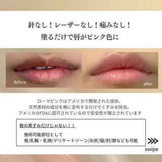 ニキビ/肌質改善専門 Snow skinのエステ・リラクイメージ