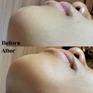 Hit. シュガーリング豊橋のエステ・リラクイメージ