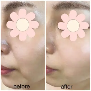 美肌フェイシャル・美肌脱毛 Di cuore所属・美肌専門 Di  cuoreのエステ・リラクイメージ