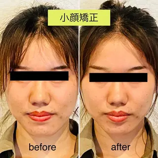 チキバン美容鍼灸整体 サロン心斎橋店のエステ・リラクイメージ