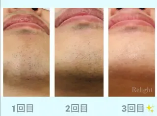 メンズ ロング Relight あかりのエステ・リラクイメージ