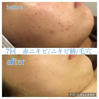 ロング カラー パーマ ヘアアレンジ メンズ ネイル マツエク・マツパ Ensor Clair所属・EnsorClair 代表　野口真央のエステ・リラクイメージ