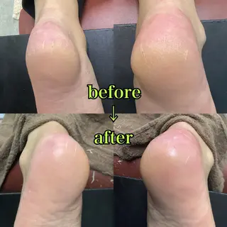 ヒューマン 鍼灸接骨院所属・リラク/ネイル/ 足裏ケア/蛭川栞のエステ・リラクイメージ