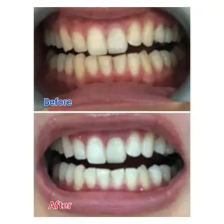 MBEAUTYSALON 千葉店・京成大久保所属・Melty 輝のその他イメージ