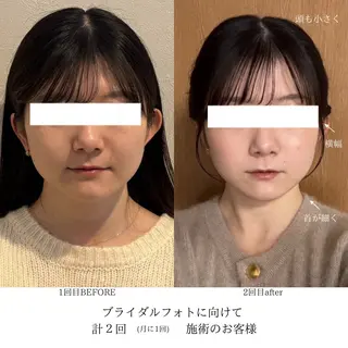 小顔|痩身salon miélu ミエルのエステ・リラクイメージ