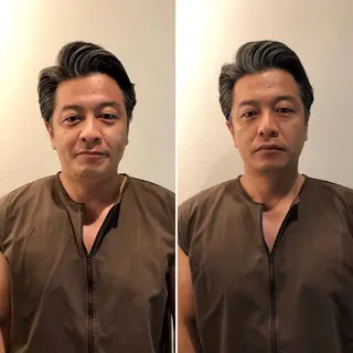 メンズ 即小顔♥️美容鍼× ハーブピーリングのその他イメージ