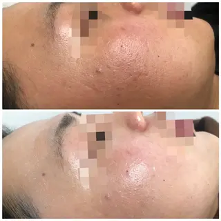 メンズ キッズ Amaryllis 🌹のエステ・リラクイメージ