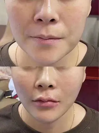 aliaハイフ&水光ジェットサロン所属・aliaハーブ水光店 エステティシャン募集のエステ・リラクイメージ