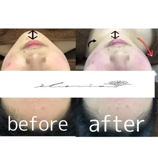 心斎橋痩身ダイエット 韓国.美容鍼.小顔のエステ・リラクイメージ