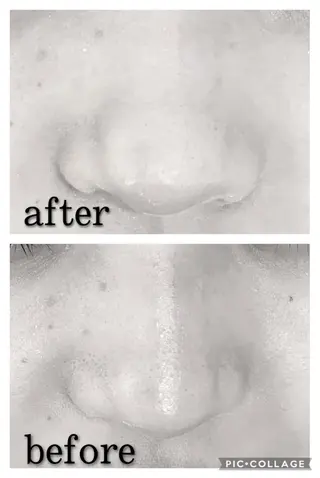 ミディアム カラー パーマ ヘアアレンジ メンズ キッズ ネイル マツエク・マツパ アイブロウ ニキビ特化型エステ 🍓最短で肌質改善のエステ・リラクイメージ