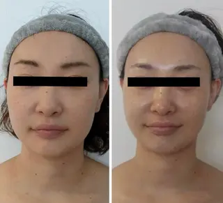 M.plus所属・水光韓国肌ハーブ ピーリングMplusのエステ・リラクイメージ