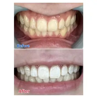 M渋谷店所属・Ｍ渋谷 ホワイトニングのその他イメージ