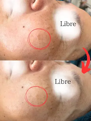 小顔コルギ&肌質改善 の専門店LIBREのエステ・リラクイメージ