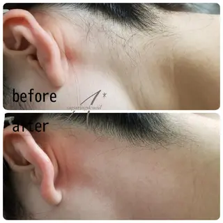 A*《エースター》 シュガーリング🍋のエステ・リラクイメージ