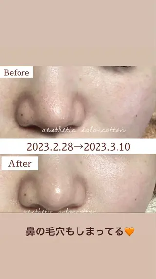 都度払い 肌質改善専門サロンのエステ・リラクイメージ