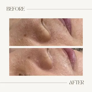 CEsalonEgg 齋藤のエステ・リラクイメージ