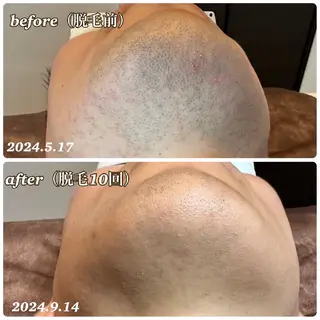 都度払いエステ Un Reve メンズ&レディース 津幡店所属・石黒 奈美子のエステ・リラクイメージ