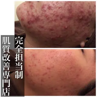 ミディアム カラー パーマ ヘアアレンジ メンズ キッズ ネイル マツエク・マツパ ニキビ・肌質改善専門 ♡人生が変わるサロンのエステ・リラクイメージ