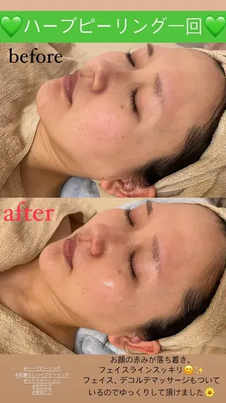 Salon de Lino 御器所のエステ・リラクイメージ