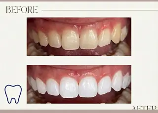 セルフホワイトニング サクッとホワイト 立川店所属・サクッとホワイト 立川店のその他イメージ