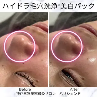 美容鍼・小顔矯正 ハリシェンドのエステ・リラクイメージ