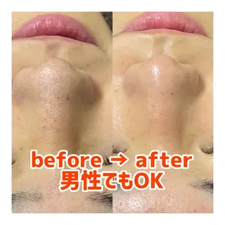 〜小顔・痩身・リラクゼーション〜　　Y&o Esthetic  Salon所属・HANA MIKIの眉毛・アイブロウイメージ