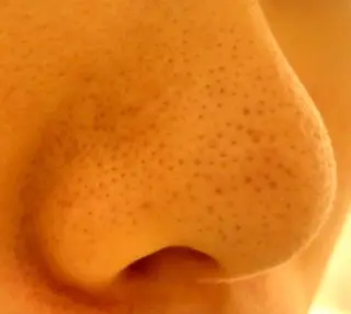 ピーリングサロン シャンテールのエステ・リラクイメージ