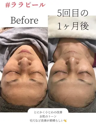 天神 MeMeのエステ・リラクイメージ