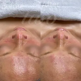 《心斎橋》 twoのエステ・リラクイメージ