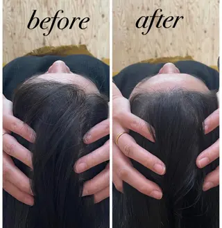 ate'所属・個室ドライヘッドスパ 🍃moriのエステ・リラクイメージ