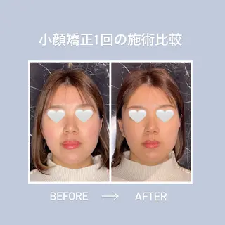 THE  ROOTS所属・美容鍼♡小顔矯正♡ fumikaのエステ・リラクイメージ