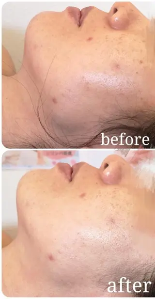 🅖🅤🅩🅔🅛 salonのエステ・リラクイメージ