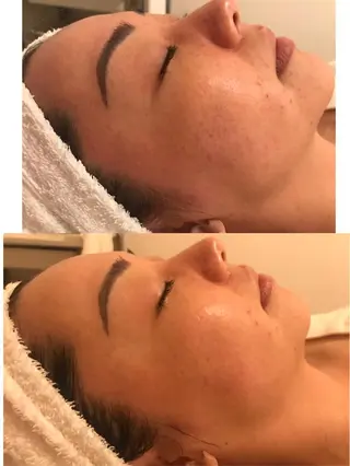 エステサロン endearのエステ・リラクイメージ