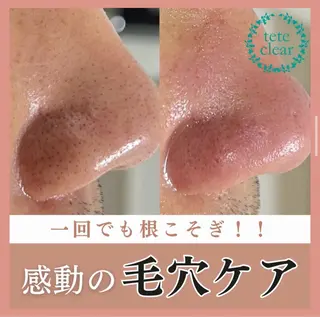 メンズ HIKARI a.k.a 神童♡のエステ・リラクイメージ