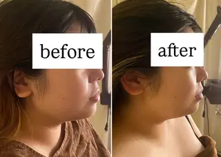 99-KUKU-所属・天神美容鍼99 -KUKU-吉弘萌香のエステ・リラクイメージ