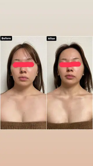 透明感の肌Lino malieのエステ・リラクイメージ